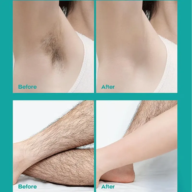 Painless Full Body Hair Removal Cream for Men & Women Skin-friendly for all areas
