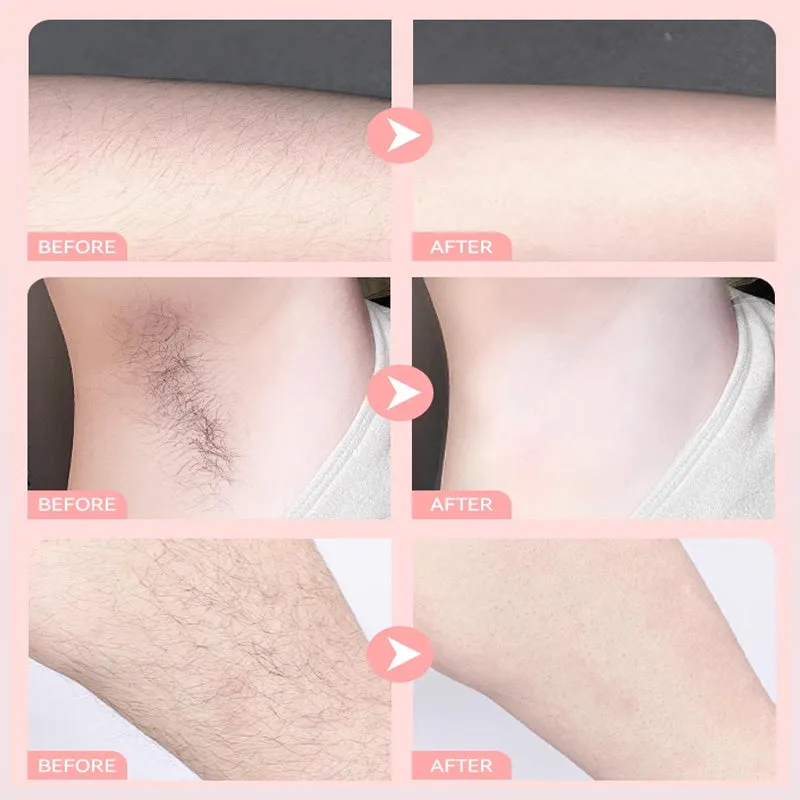 Summer Hot SaleConvenient Gentle Hair Removal Cream