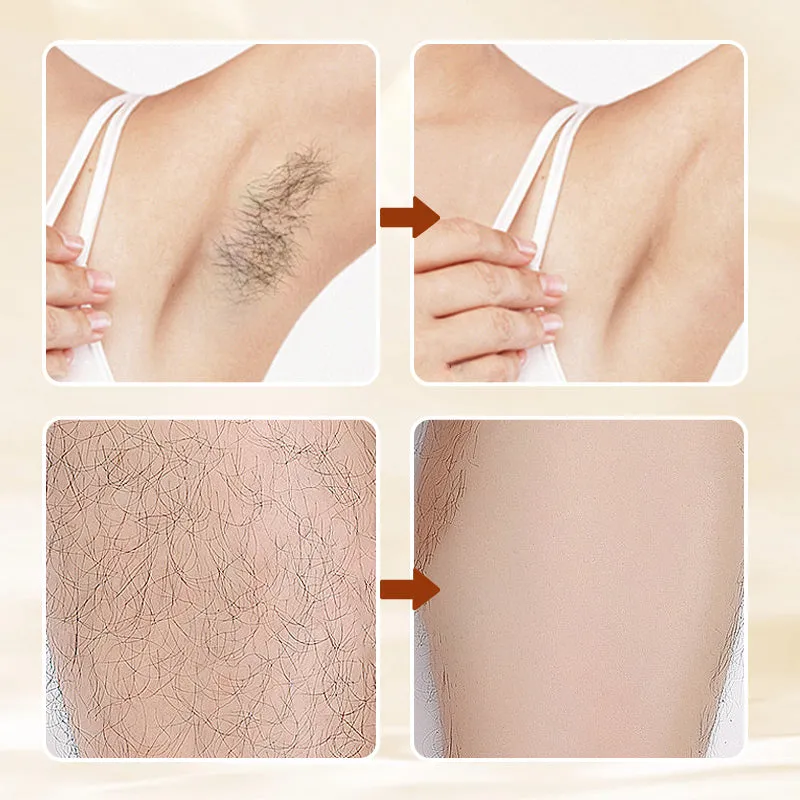 Versatile Aromatic  Hair Removal Cream